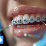 بهترین کلینیک های ارتودنسی دندان در تهران [ تهران کلینیک : tehranclinik ir ] ارتودنسی دندان در تهران