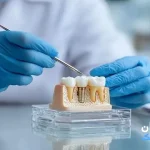 بهترین کلینیک های ایمپلنت دندان در تهران [ تهران کلینیک : tehranclinik ir ] ایمپلنت دندان در تهران