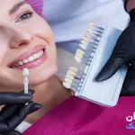 بهترین کلینیک های لمینت دندان در تهران [ تهران کلینیک : tehranclinik ir ] لمینت دندان در تهران