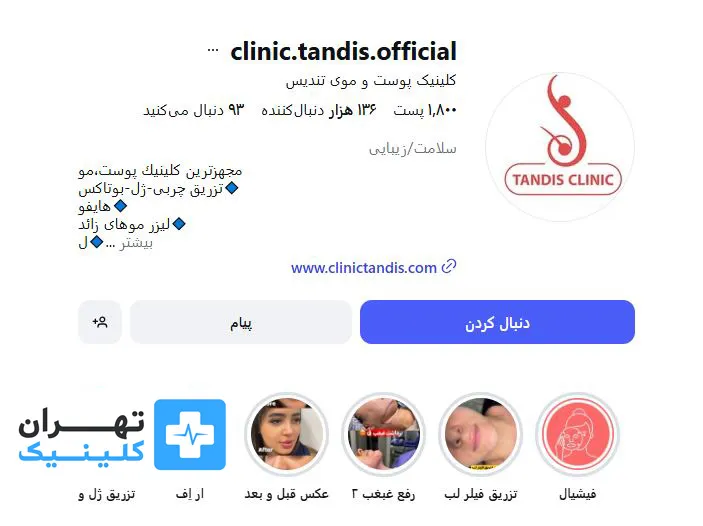کلینیک لیزر موهای زائد تنديس | تهران کلینیک