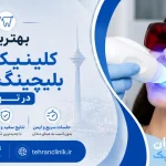 بهترین کلینیک های بلیچینگ دندان در تهران [ دایرکتوری تهران کلینیک : tehranclinik ir ]