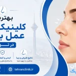 بهترین کلینیک های عمل بینی در تهران [ دایرکتوری تهران کلینیک : tehranclinik ir ]