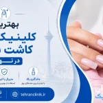 بهترین کلینیک های کاشت ناخن در تهران [ دایرکتوری تهران کلینیک : tehranclinik ir ]