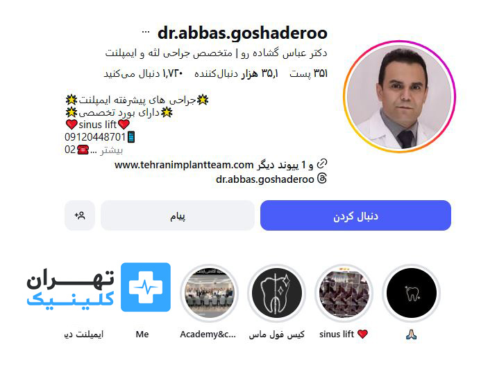  کلینیک ایمپلنت دندان دکتر عباس گشاده رو | تهران کلینیک