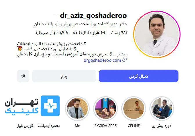 کلینیک لمینت دندان دکتر عزیز گشاده رو | تهران کلینیک