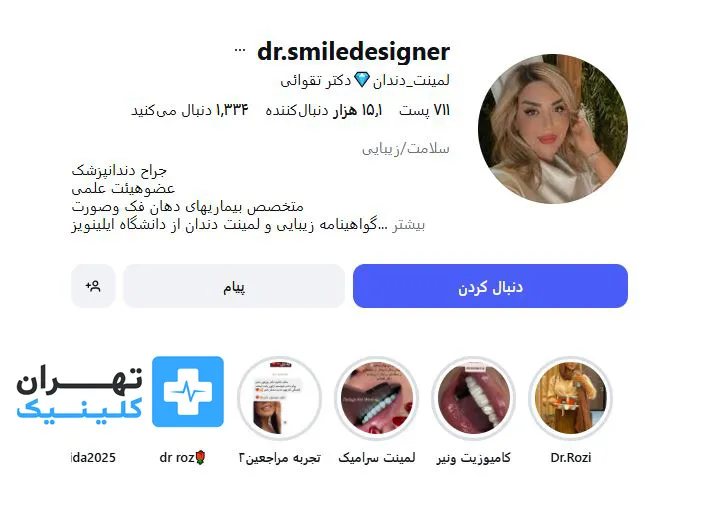 کلینیک لمینت دندان دکتر عطیه تقوایی | تهران کلینیک