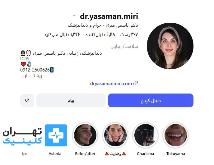 کلینیک لمینت دندان دکتر یاسمن میری | تهران کلینیک