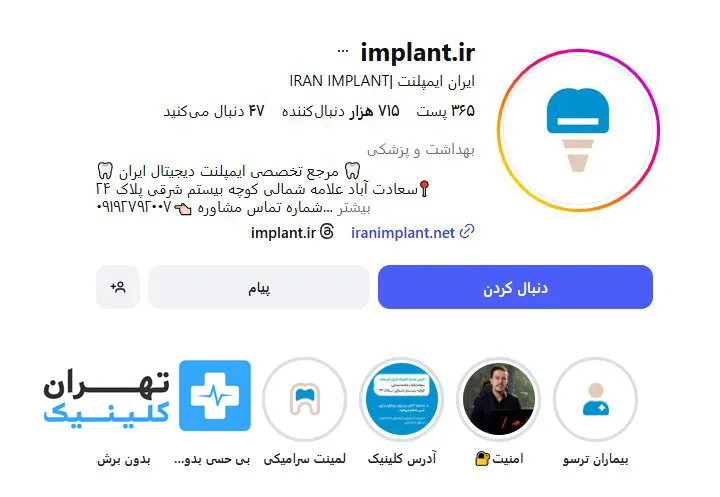 کلینیک ایمپلنت دندان ایران ایمپلنت | تهران کلینیک