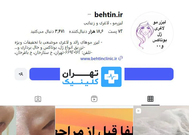 کلینیک بوتاکس بهتین | تهران کلینیک