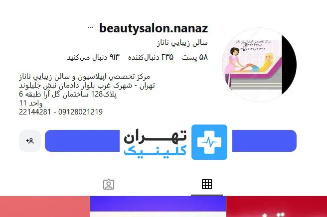 کلینیک اپیلاسیون ناناز | تهران کلینیک